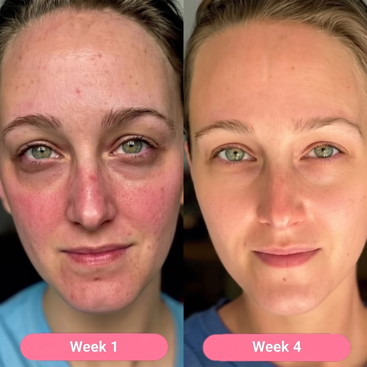 Pheroeli Korean Collagen Serum