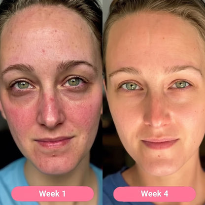 Pheroeli Korean Collagen Serum